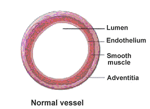 Diagram showing normal vessel
